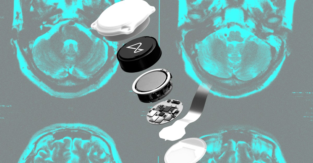 Neuralink có đang đi sai hướng khi chuyển dịch từ điều khiển ý chí sang khôi phục giọng nói?