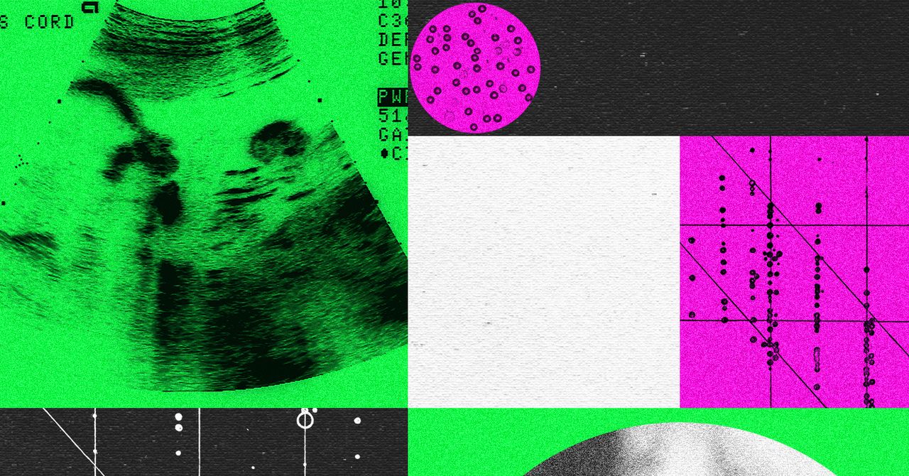 Hai công ty khởi nghiệp chỉnh sửa gen phôi thai đóng cửa vì thiếu vốn và mâu thuẫn