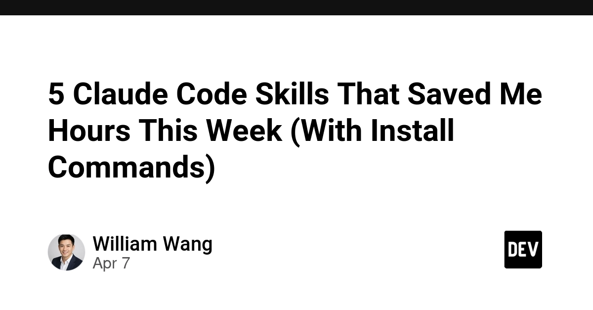 5 kỹ năng Claude Code giúp tiết kiệm hàng giờ cho lập trình viên