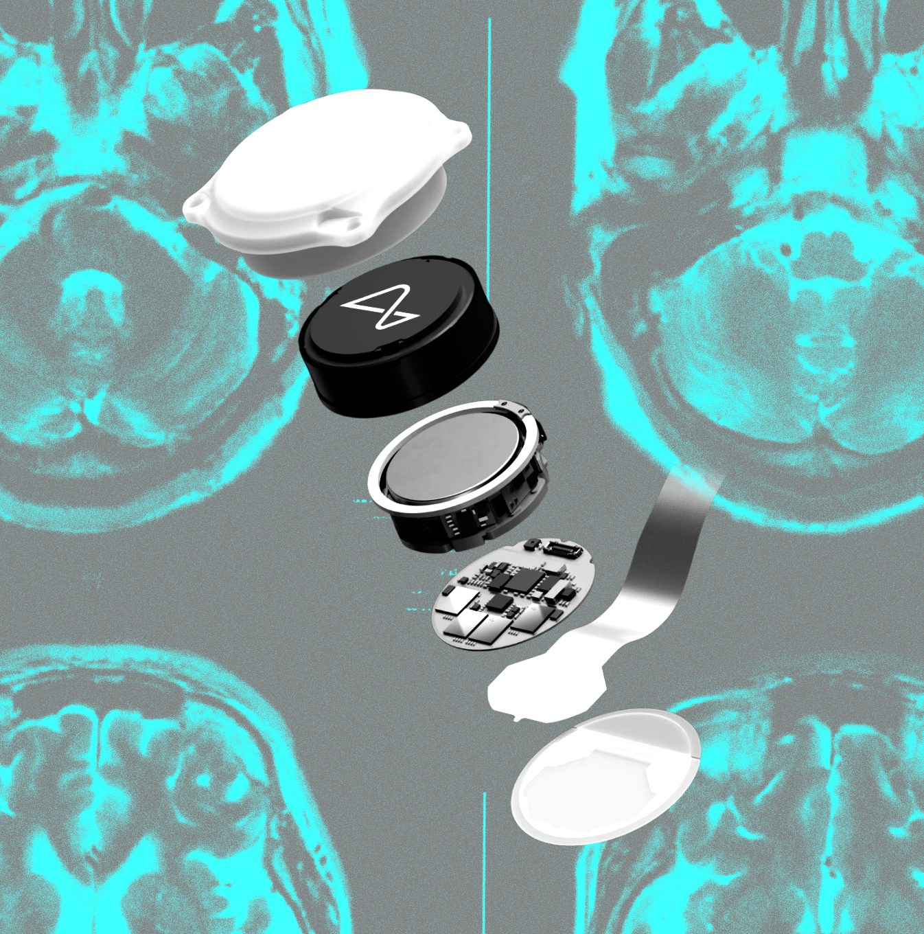 Hình ảnh minh họa so sánh các công nghệ BCI