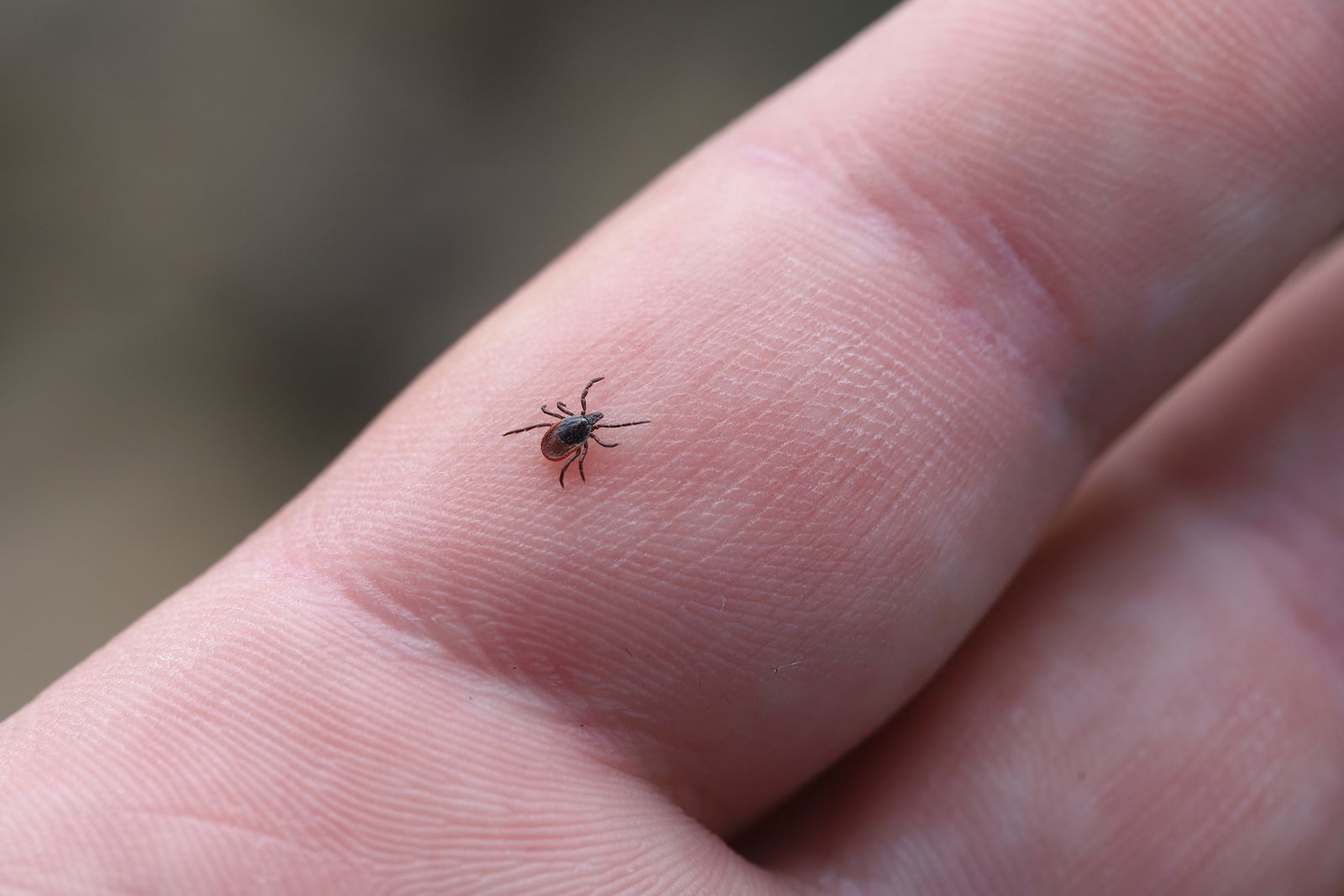 LymeAlert: Bộ xét nghiệm tại nhà đầu tiên giúp chẩn đoán sớm bệnh Lyme từ vết cắn của ve