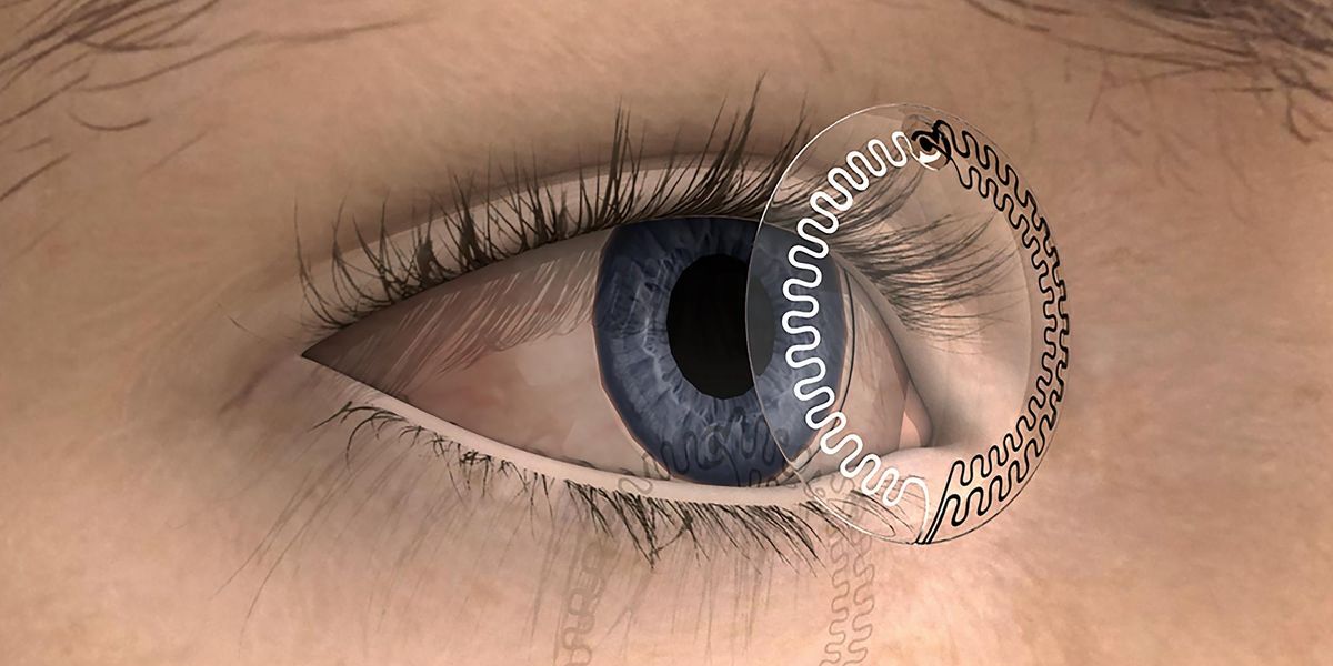 Kính áp tròng thông minh đo nồng độ serotonin để theo dõi căng thẳng