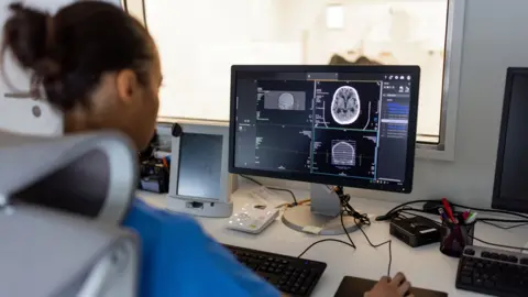 Mô não người phát triển trong môi trường não chuột