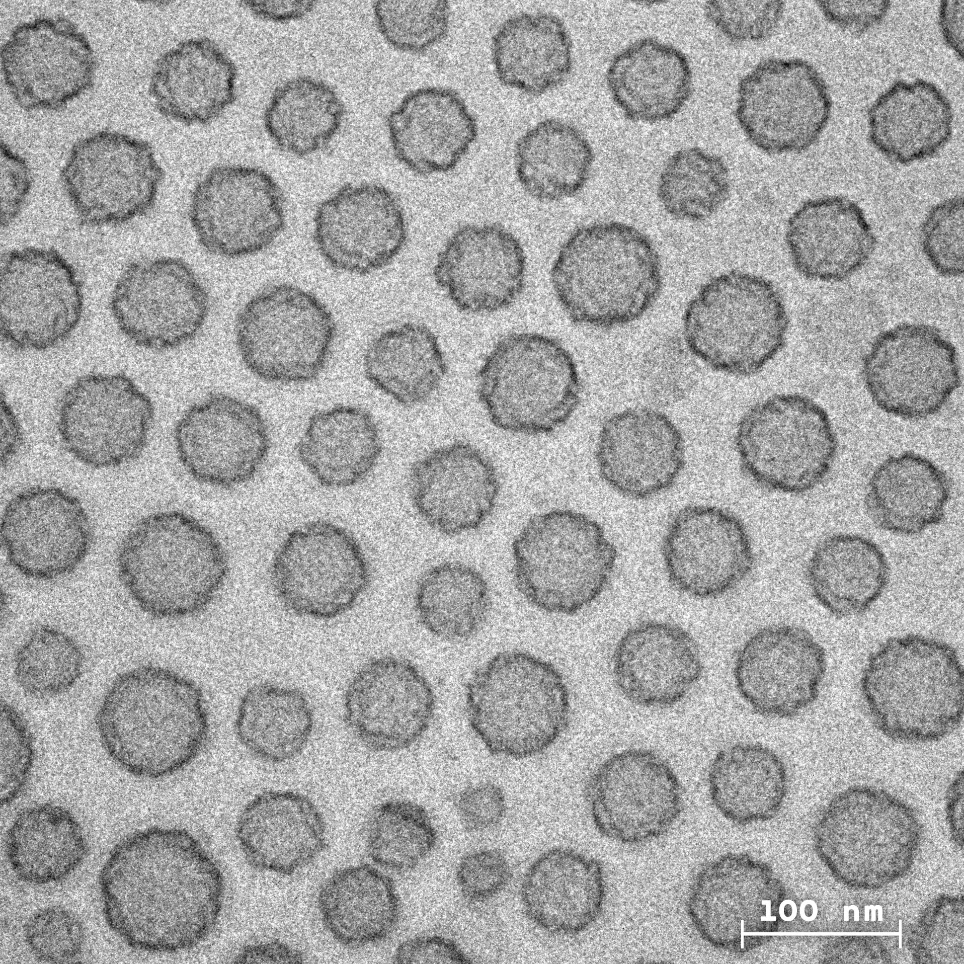 Tiểu cầu nhân tạo SynthoPlate dưới kính hiển vi điện tử